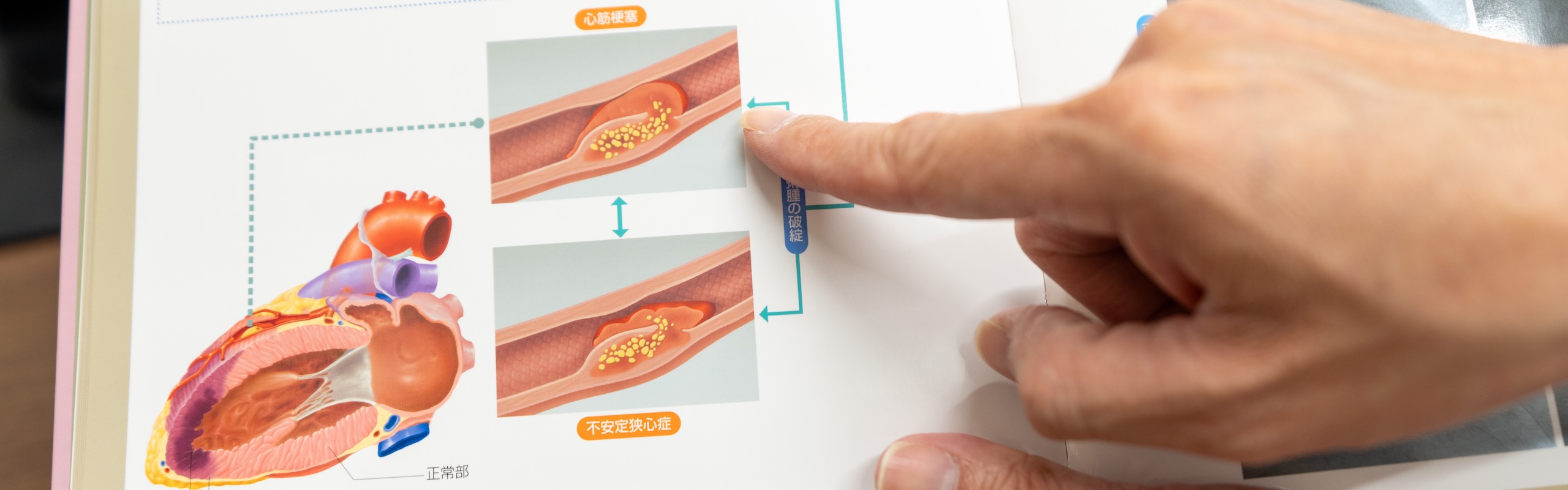 具体的で実践的な生活指導 パンフレットを活用した継続可能な改善策